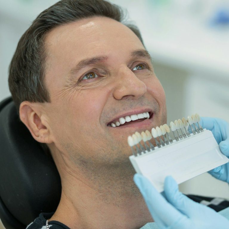 sbiancamento promozione denti bianchi